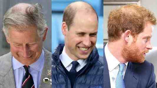 头发英语怎么读(头发英语怎么读ear)