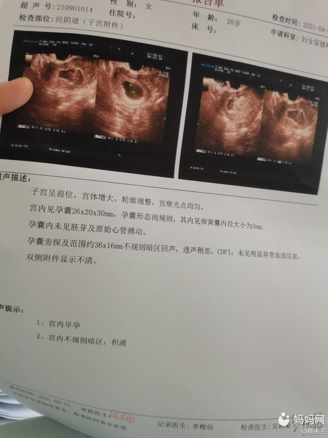 六周是多少天(医生说的六周是多少天)