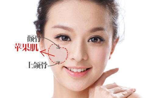 苹果肌填充(苹果肌填充用什么材料好)