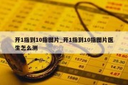 开1指到10指图片_开1指到10指图片医生怎么测